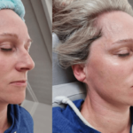 Top Cryotherapy Trends for 2026: Personalized and Holistic Recovery