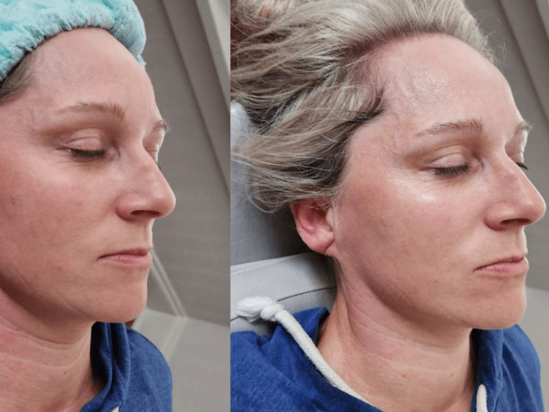 Top Cryotherapy Trends for 2026: Personalized and Holistic Recovery